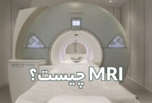 MRI چیست