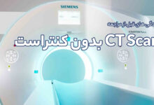آمادگی های قبل از مراجعه انجام CT Scan بدون کنتراست