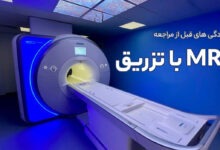 ام ار ای با تزریق