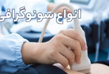 انواع سونوگرافی و آمادگی های قبل از مراجعه