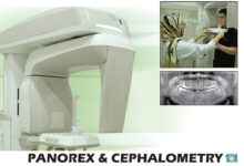 رادیوگرافی دندان پانوركس OPG