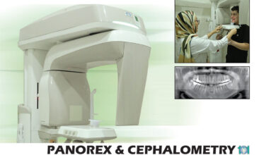 رادیوگرافی دندان پانوركس OPG