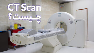 سی تی اسکن CTscan چیست