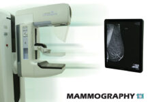 ماموگرافی دیجیتال هولژیک