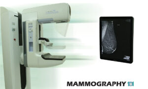 ماموگرافی دیجیتال هولژیک