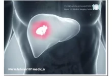ام آر آی کبد