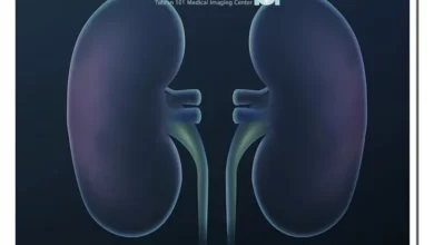 روشی دقیق برای بررسی سلامت کلیهها 9 روشی دقیق برای بررسی سلامت کلیهها
