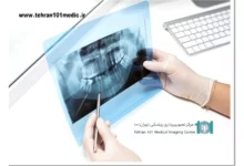 تفسیر عکس رادیوگرافی دندان