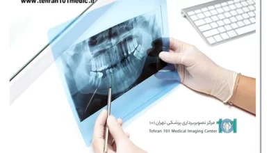 تفسیر عکس رادیوگرافی دندان