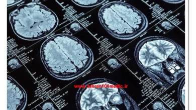 آیا ام آر آی مغز خطرناک است