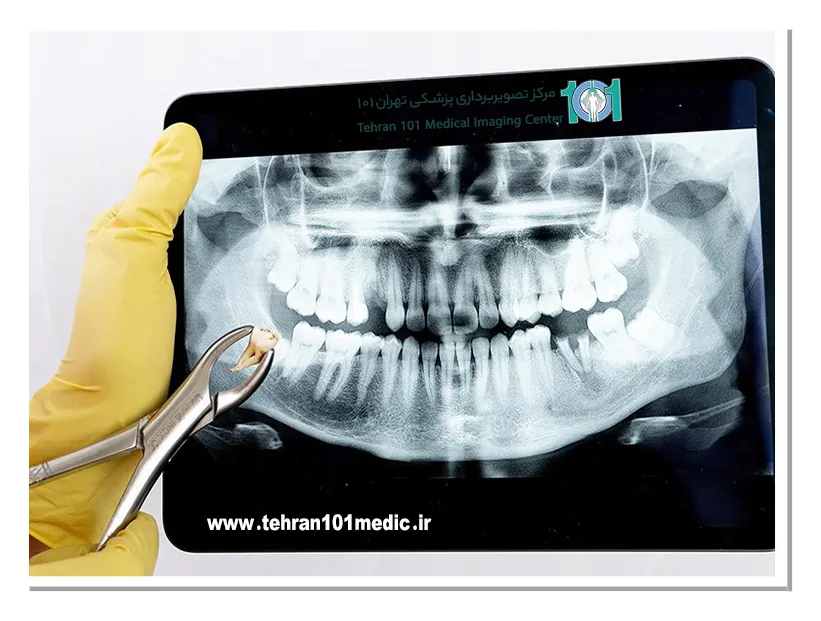 اساس کار رادیوگرافی دندان