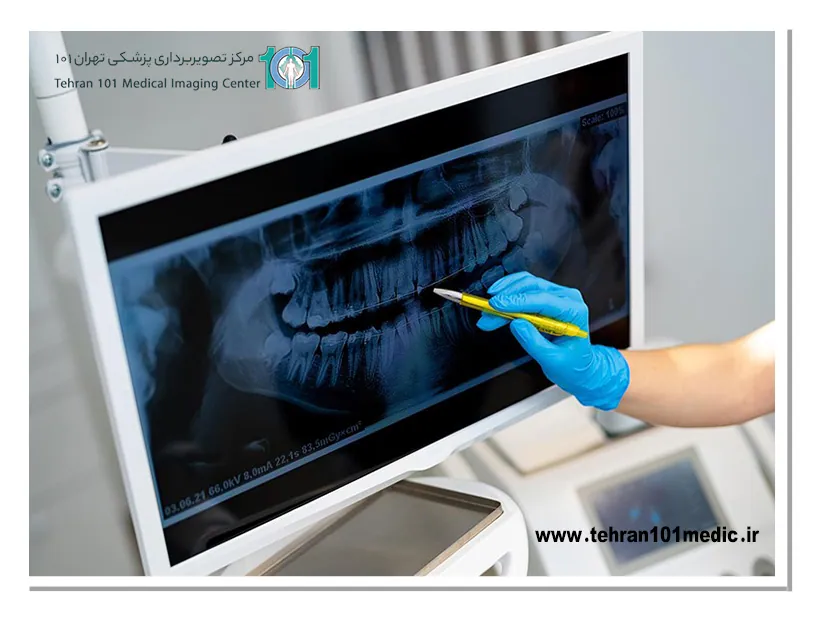 انواع رادیوگرافی دندان