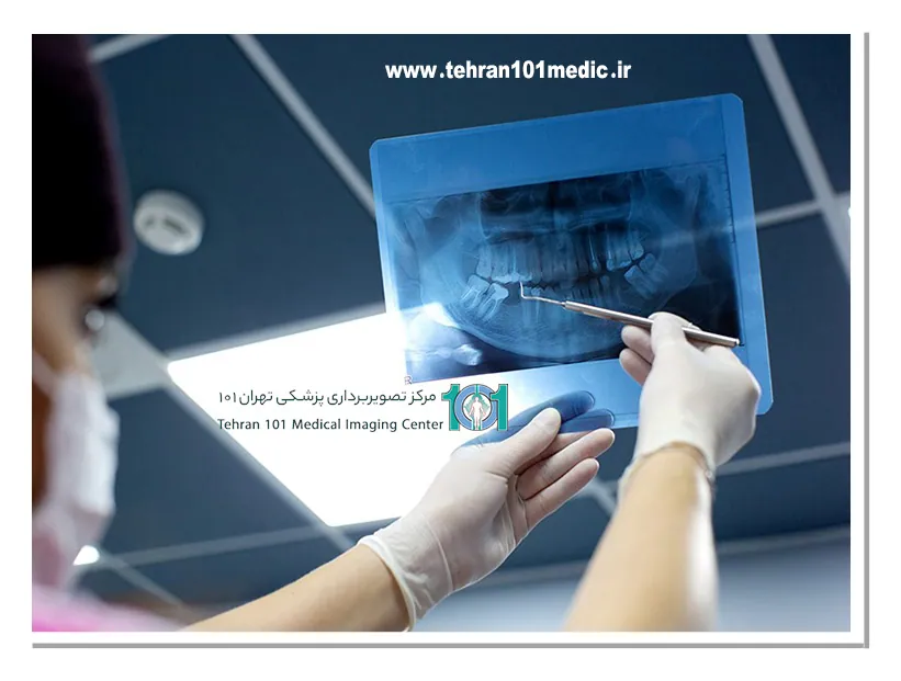 انواع رادیولوژی دندان