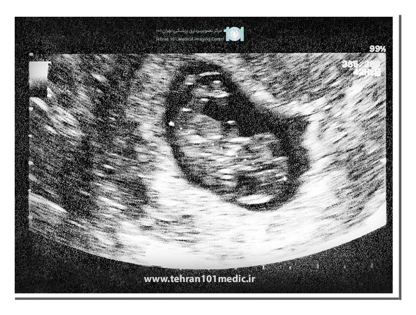 سونوگرافی و نقایص مادرزادی