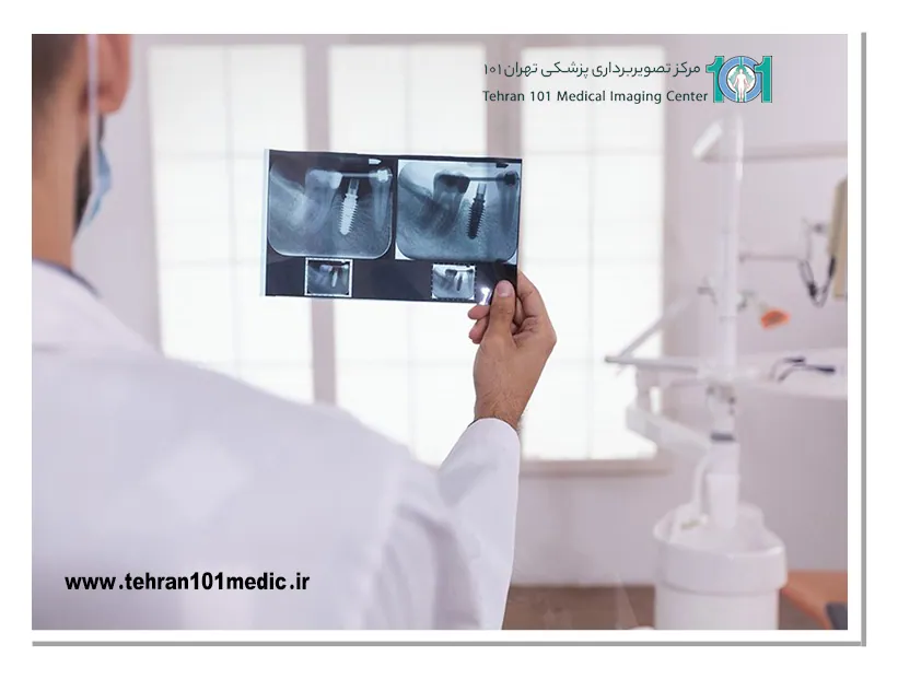 رادیوگرافی دندان چیست
