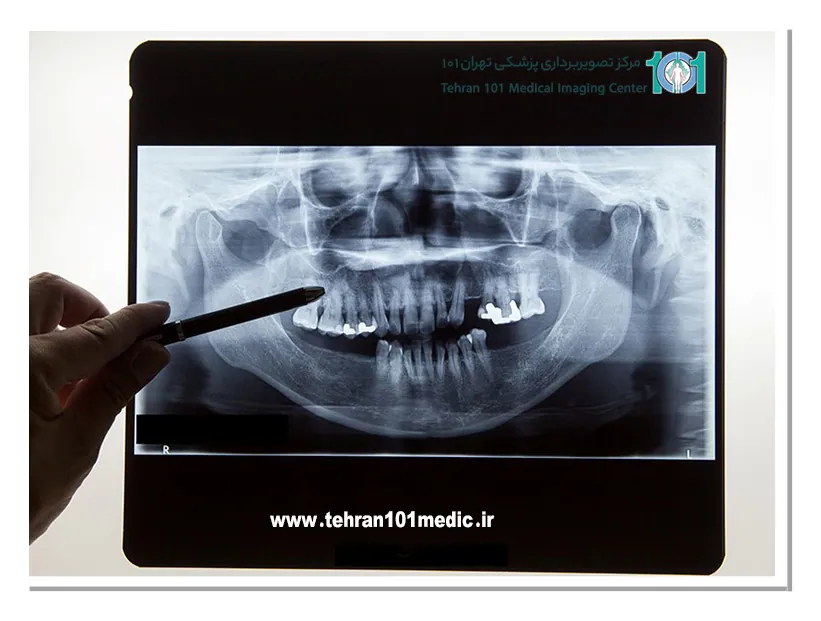 ساختار دندان