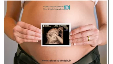 سونوگرافی سه بعدی چیست؟ 11 سونوگرافی سه بعدی