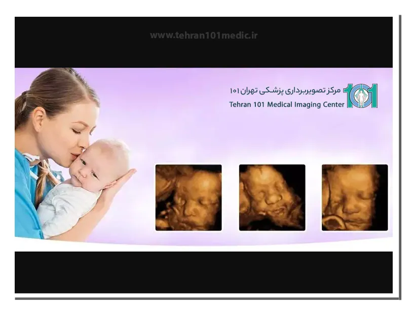 سونوگرافی سه بعدی چیست؟ 3 متخصصین تصویر برداری سونوگرافی سه بعدی