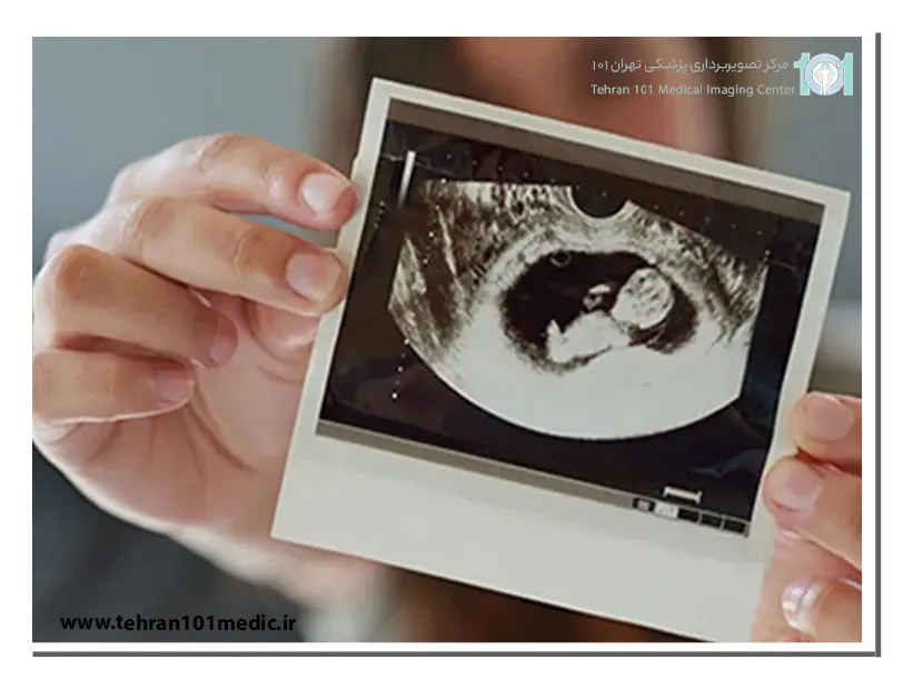 سونوگرافی آنومالی: تشخیص زود هنگام مشکلات جنینی 5 اندازهگیریهای سونوگرافی آنومالی