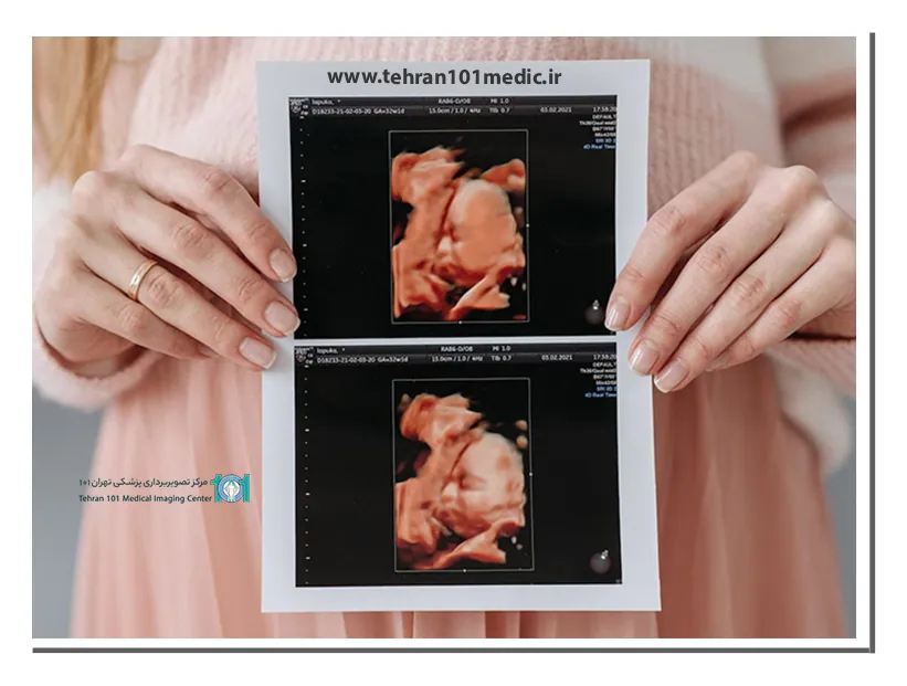سونوگرافی سه بعدی چیست؟ 2 مزایای سونوگرافی سه بعدی