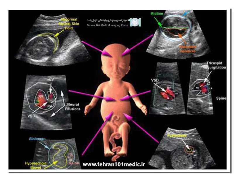 انجام سونوگرافی داپلر در بارداری