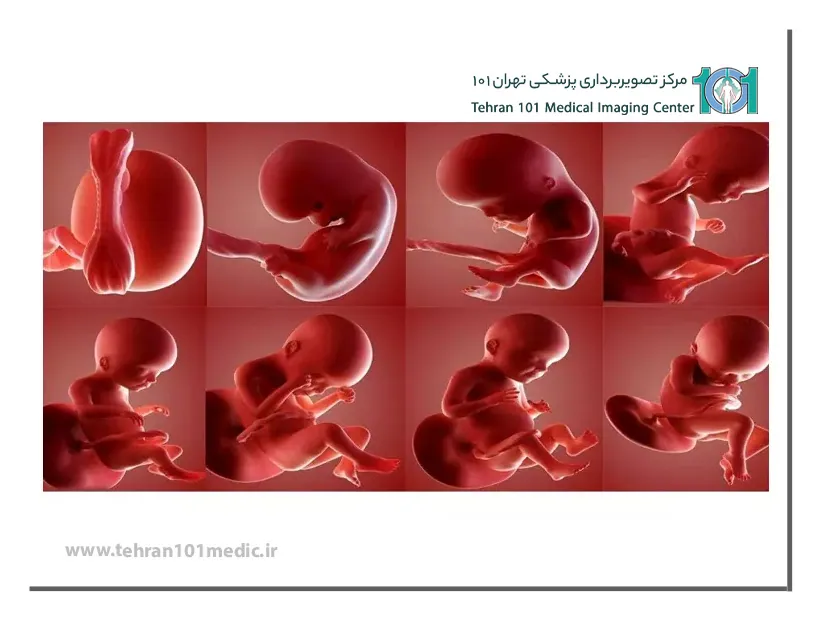 علت های انجام سونوگرافی در بارداری