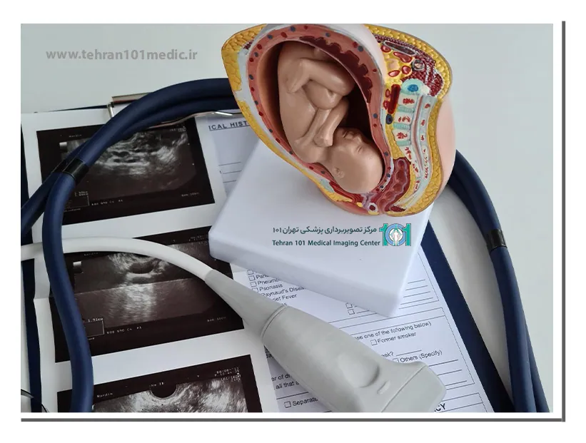 بهترین زمان برای انجام تشخیص درست جنسیت جنین