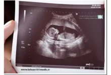 اشتباه سونوگرافی در تشخیص جنسیت جنین دختر