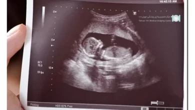 اشتباه سونوگرافی در تشخیص جنسیت جنین دختر