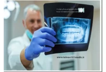 رادیوگرافی دندان