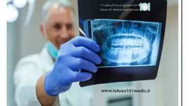 انواع رادیوگرافی دندان 3 رادیوگرافی دندان