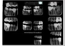 هزینه رادیوگرافی دندان
