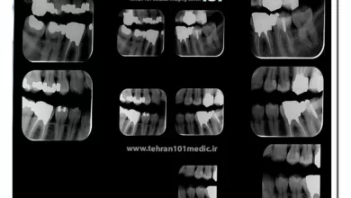 هزینه رادیوگرافی دندان