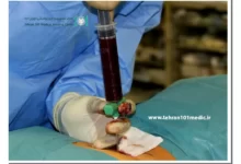 بیوپسی چیست