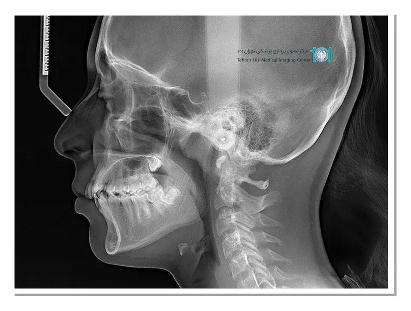 مزایا و خطرات رادیولوژی