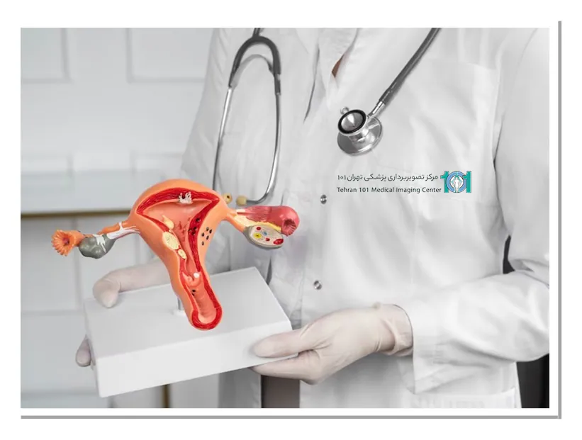 مراقبت های بعد از نمونه برداری از رحم