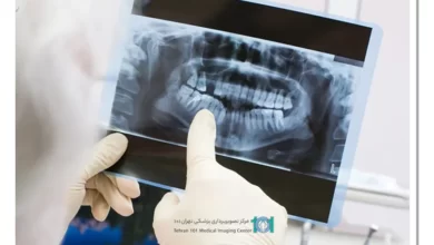 رادیولوژی فک و صورت 1 رادیولوژی فک و صورت