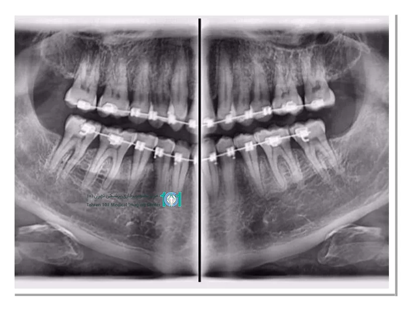شرایط موردنیاز برای رادیولوژی فک و صورت