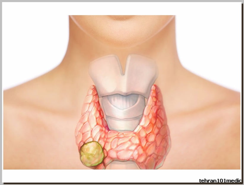 ? سونوگرافی تیروئید و پاراتیروئید در 2024 3 سونوگرافی تیروئید و پاراتیروئید
