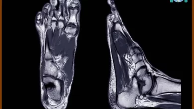 آمادگی برای ام آر آی پا، آنچه باید بدانید 3 ام آر آی پا