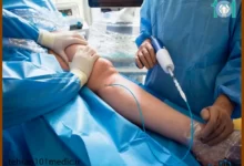 آنژیوگرافی عروق محیطی چیست؟