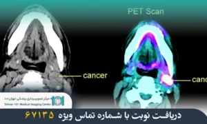 تفاوت سی تی اسکن و پت اسکن چیست؟ بررسی کامل مقایسه دو روش تصویربرداری پزشکی 3 تفاوت سی تی اسکن و پت اسکن