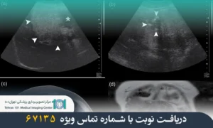 تفاوت سونوگرافی و سی تی اسکن چیست؟ بررسی مقایسهای دو روش تصویربرداری پزشکی 4 تفاوت سونوگرافی و سی تی اسکن