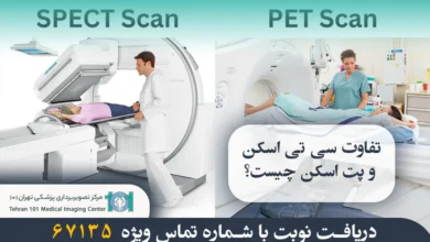 تفاوت سی تی اسکن و پت اسکن چیست؟ بررسی کامل مقایسه دو روش تصویربرداری پزشکی 50 تفاوت سی تی اسکن و پت اسکن چیست؟