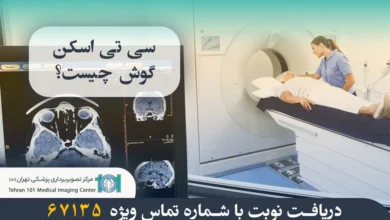 سی تی اسکن گوش چیست و چه کاربردهایی دارد؟ بررسی مراحل انجام و دلایل استفاده از آن 3 سی تی اسکن گوش چیست؟