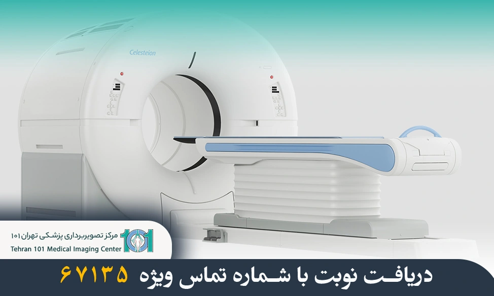 سی تی اسکن مغز چیست و چه کاربردی دارد؟ 3 سی تی اسکن مغز چیست؟