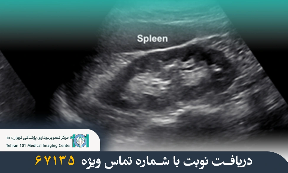 سونوگرافی کلیه و مجاری ادراری چیست و چه کاربردی دارد؟ 4 سونوگرافی کلیه و مجاری ادراری