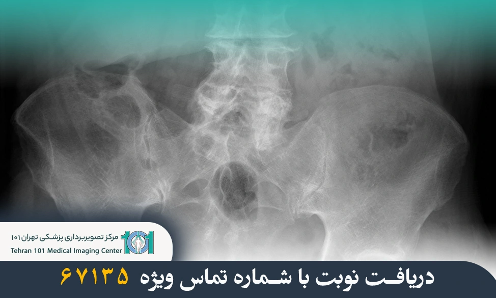 راهنمای کامل آمادگی برای رادیولوژی کمر