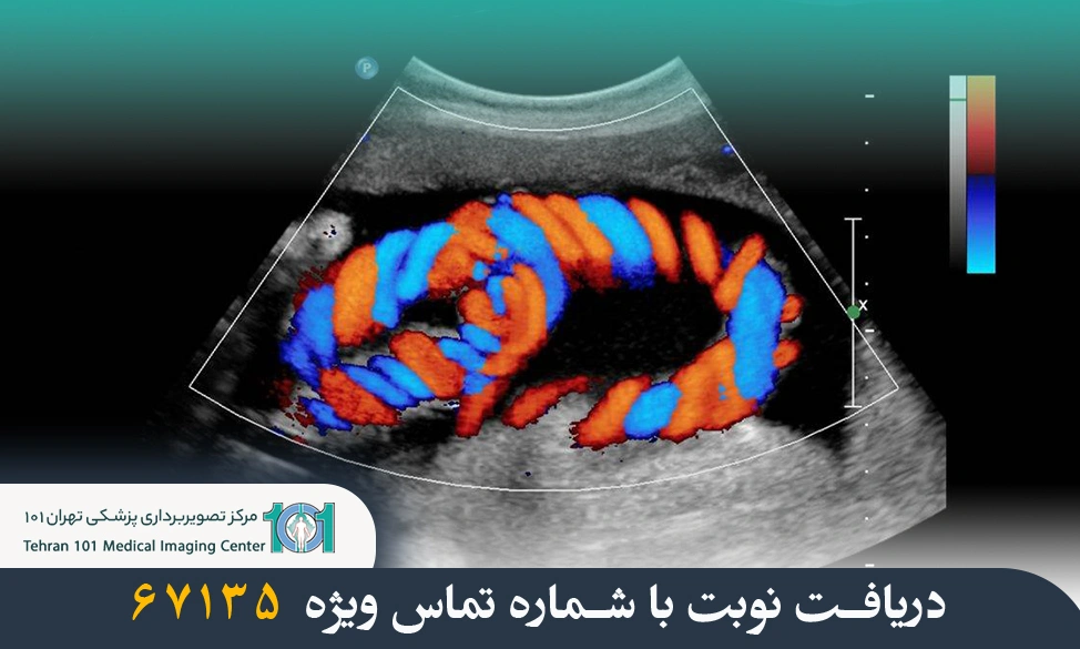 سونوگرافی کالر داپلر سینه