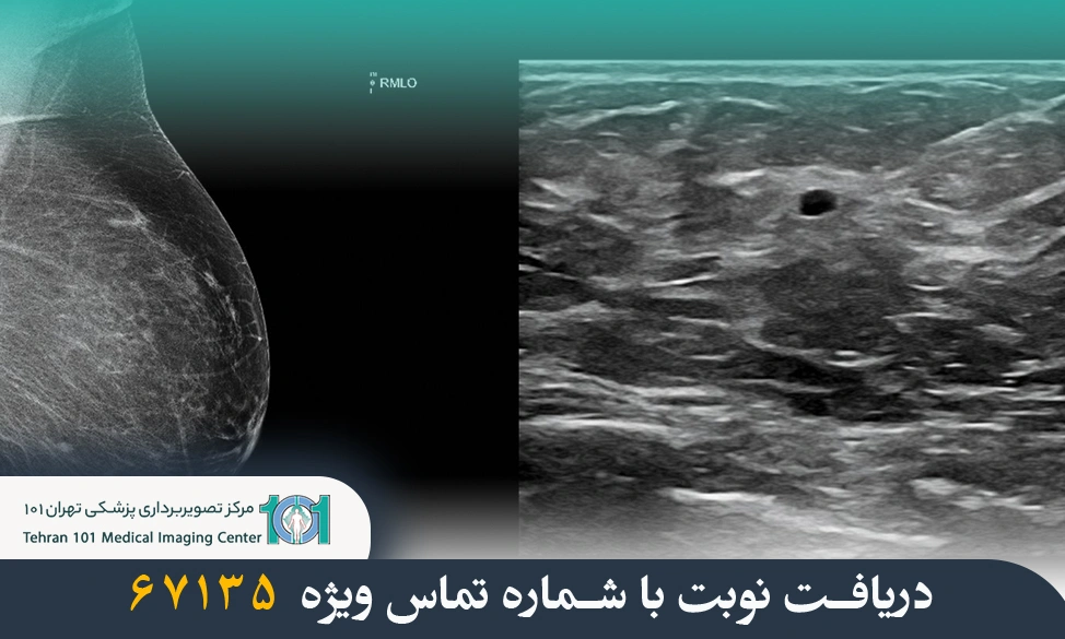 اصطلاحات مهم در ماموگرافی و سونوگرافی پستان – راهنمای جامع 3 اصطلاحات مهم در ماموگرافی و سونوگرافی پستان